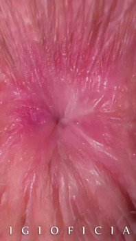 Mix of Every Sex of Mine Since I Was 18 Years Old