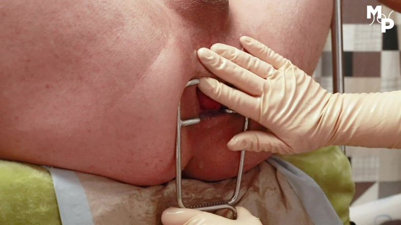 Marcus Pollack: Extreme femdom fisting and prolapse play