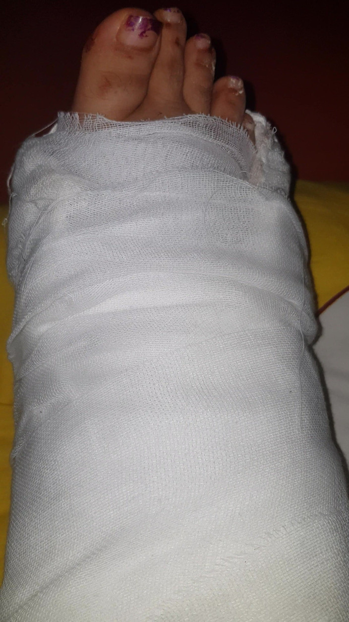 LoraBbw: Oyuncu seçmelerinde ayak parmaklarımı oynatıyor