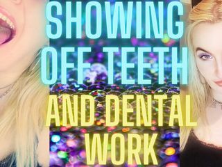 Monica Nylon: Showing off Teeth and Dental Work