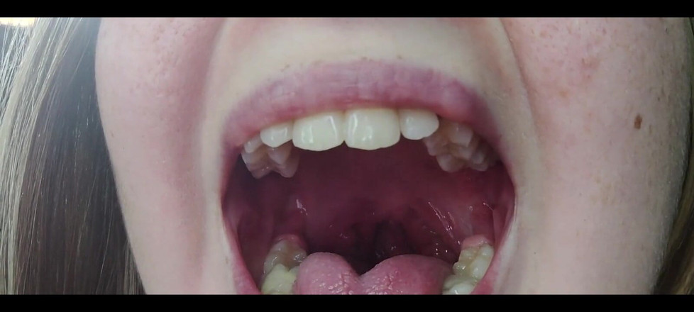 RavenHearth666VIP: Boğaz fetişi