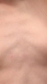 10 Women at the Breast Screening Center - Uncensored Medical Exam Fantasies - 2