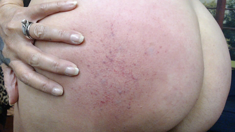 Abby Anna: リアルハードラピッドスパンキング