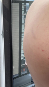 Destroyed Asshole and Cum Inside - Hot Fuck