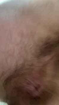 Feet Fart