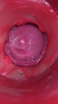 Kamera di dalam pepek: pancutan mani yang kuat dalam pepek! Asmr dalaman terbaik