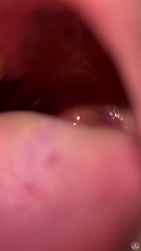 Mouth Fetish