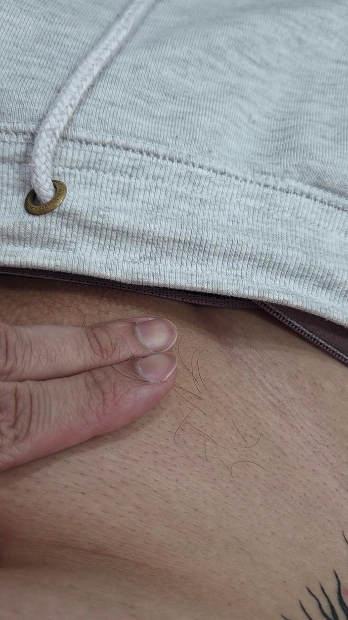 Lkdick8: Волосся на моєму пенісі — світлодіодне видалення волосся