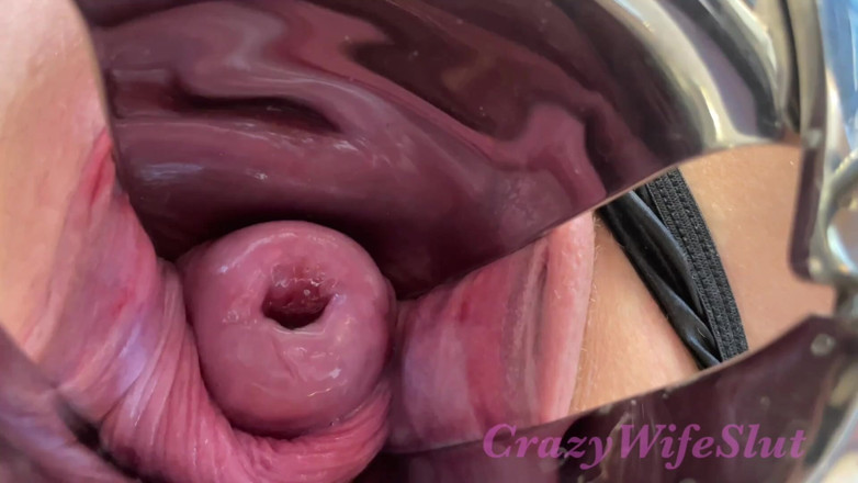 Crazywifeslut: Crazywifeslut con speculum enorme gioca con fisting e stretching