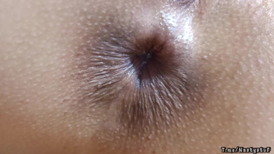anal