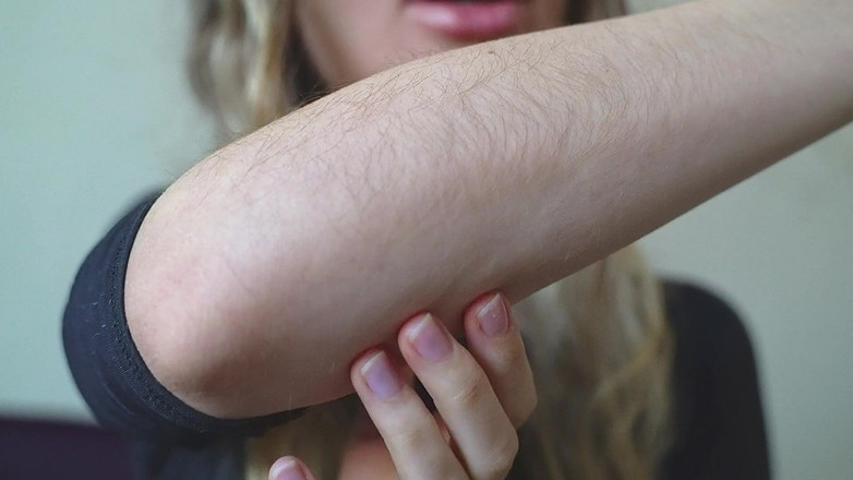 Rarible Diamond: Волохаті передпліччя на замовлення