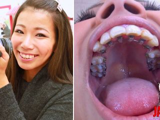 Japan Fetish Fusion: Orthodontic Teeth Fetish: Izumi Asato&#039;s Dental Fantasy