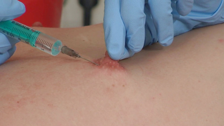 Rubber & Clinic Studio - 1ATOYS: Nadržené mučení bradavek