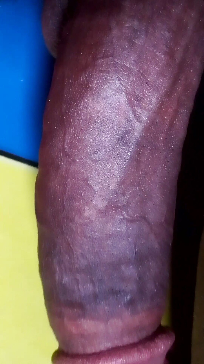 Benidick: Timpul meu de joacă cu pula