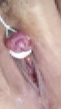 I Restrict the Clitoris That the M Woman Was Enlarged with a Thread and Let You Do the Consecutive Top
