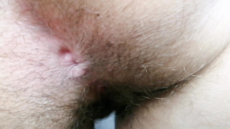 The Antichristrix: Asshole closeups compilation