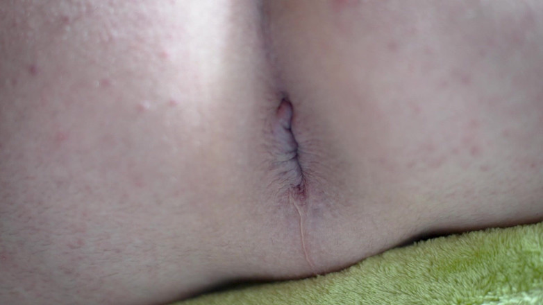 Marcus Pollack Gay: Jarak dekat bajingan