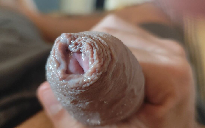 Straight Daddy Club: Great Phimosis Getting in the Way of the Boy's Orgasm