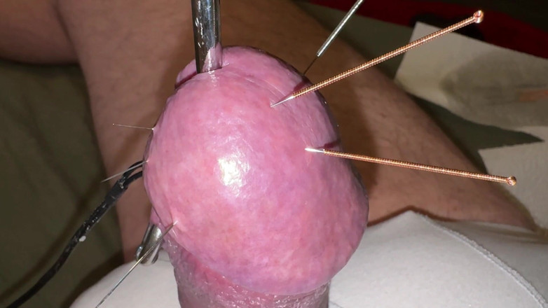 Qualzucht: Acupuncture - Orgasm!