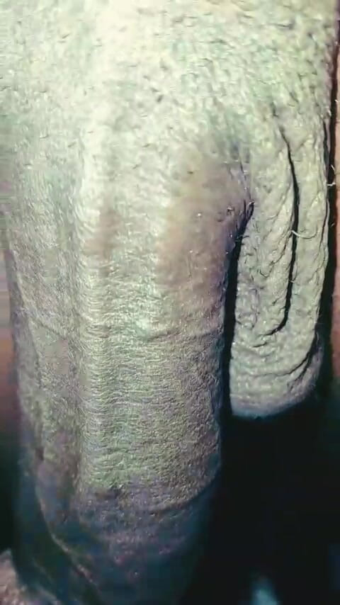 SolidmanGo: Blackdick