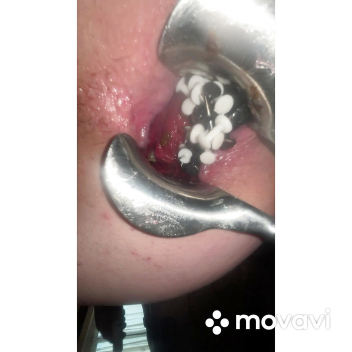 No limit cbt slave: Penyisipan anal ekstrem