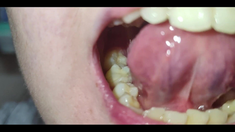 RavenHearth666VIP: A Close-up of My Throat