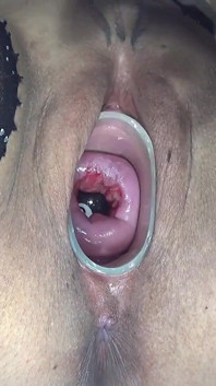Cervix Check