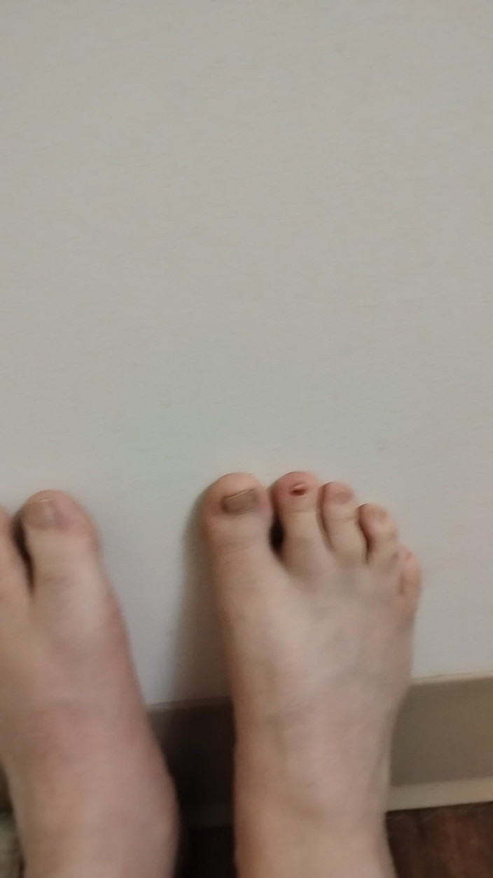 JG Risk: 11-26-2025 Roztomilé malé prsty