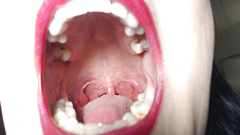 Abby Anna: 대박 후장 벌리기