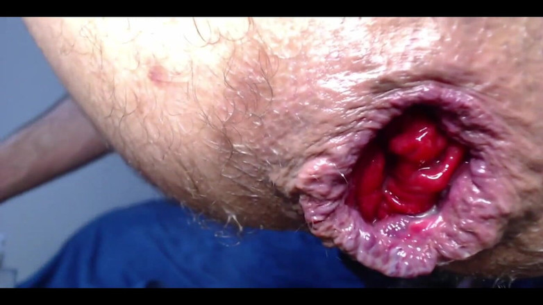 CcCrRr3321: Хорошо провел время, даже с набухшим очко ха-ха, это то, что происходит, когда вы стрекаете слишком часто