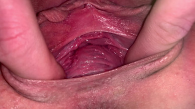 Vagina gape with cervix