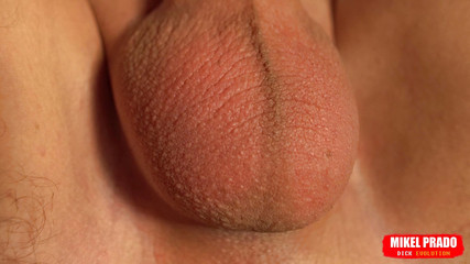 Mikel Prado: Pergerakan telur botak