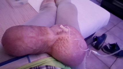 Monster_Meat_: Riempio di glucosio da 1litro