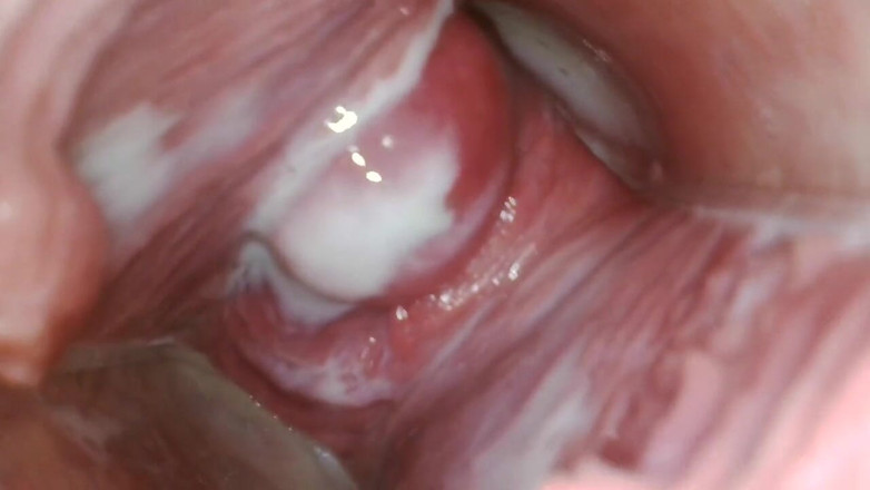 JANA studios: Endoscope in my pussy