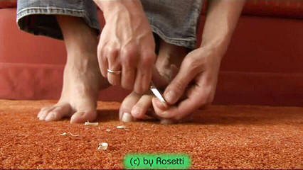 Doris Distel: Kuku yang dipotong di kaki seksi saya