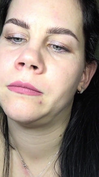 Anna mostra il suo naso ed è stata legata