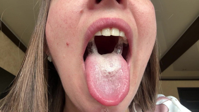 Hottie goddess: 痰の女王:湿咳のルール