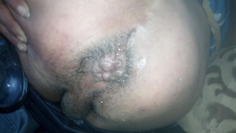 Vane_69_anal: Espansione parte 1