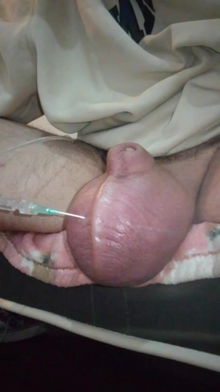 Ryan Honda: Pěkně se nakrmím grapefruitem