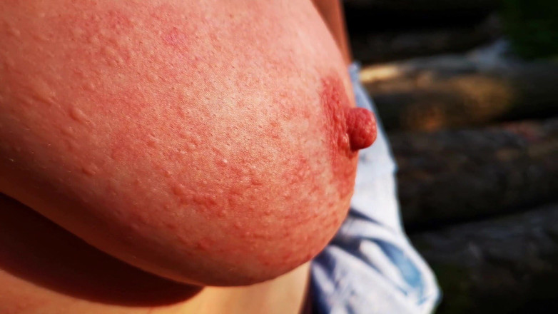 Bouncy Tits Action: 荨麻惩罚日 - 户外的屁股、奶子和阴道 - dc