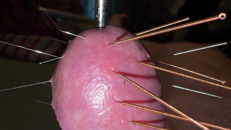 Qualzucht: Acupuncture - Orgasm!