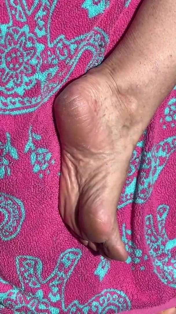 Aunt Ann: Fan Request Granny Naked in Sun Shows Dirty Rough Soles &amp;...