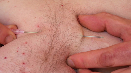 Qualzucht: Jen několik jehel ...