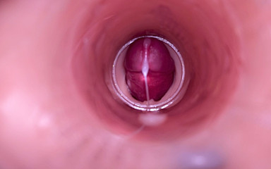 Twittiy: Female Insemination - Internal Camera Captures Deep Male Ejaculation