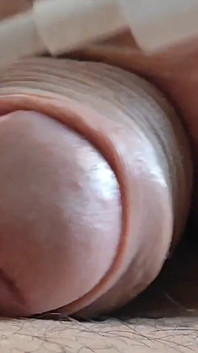 Small Electric Shocks to the Penis with the Usb Cable for Stimulation.
