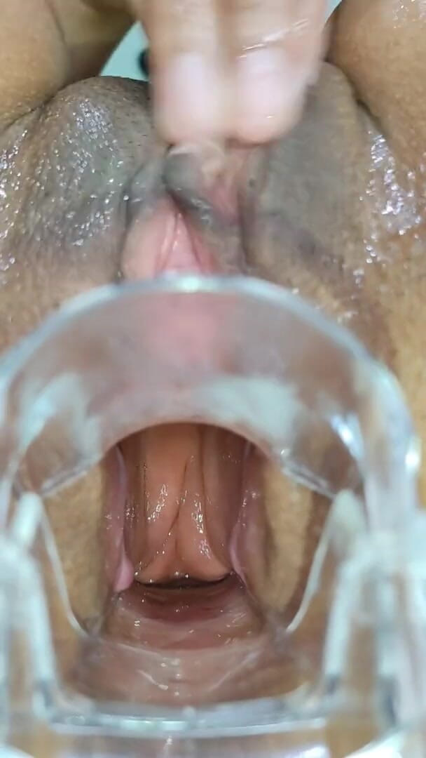 Xamy_97: Anale uitbreiding met speculum