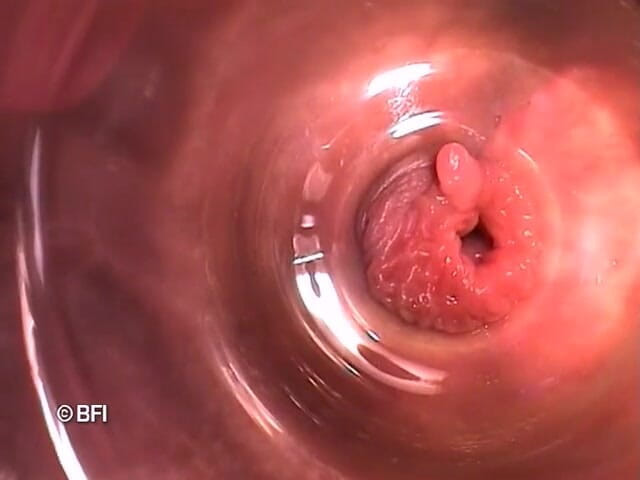 Pegging insertion: Bizarre files 162