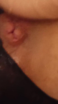 My Little Ass Hole