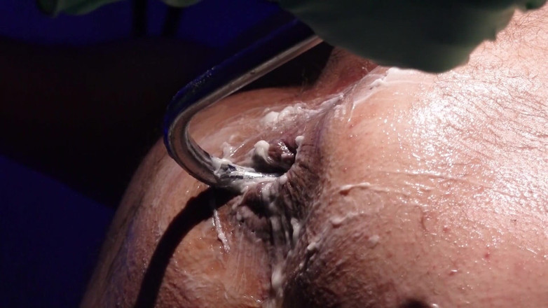 Marcus Pollack: Absolute Anal Treatment