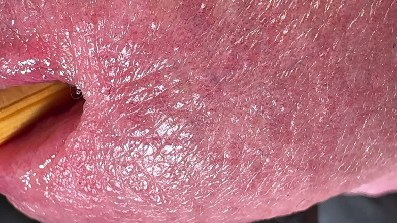 Leonardo-1974: Acorn și gaura mea mă fac fericit